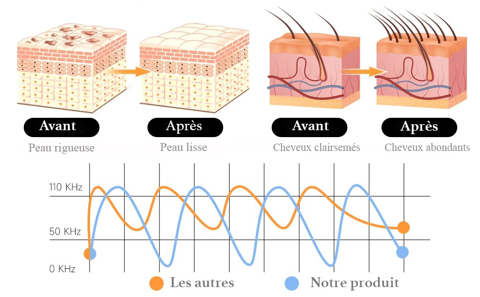 Appareil Haute Fréquence Visage & Cheveux – Soin Beauté & Électrothérapie