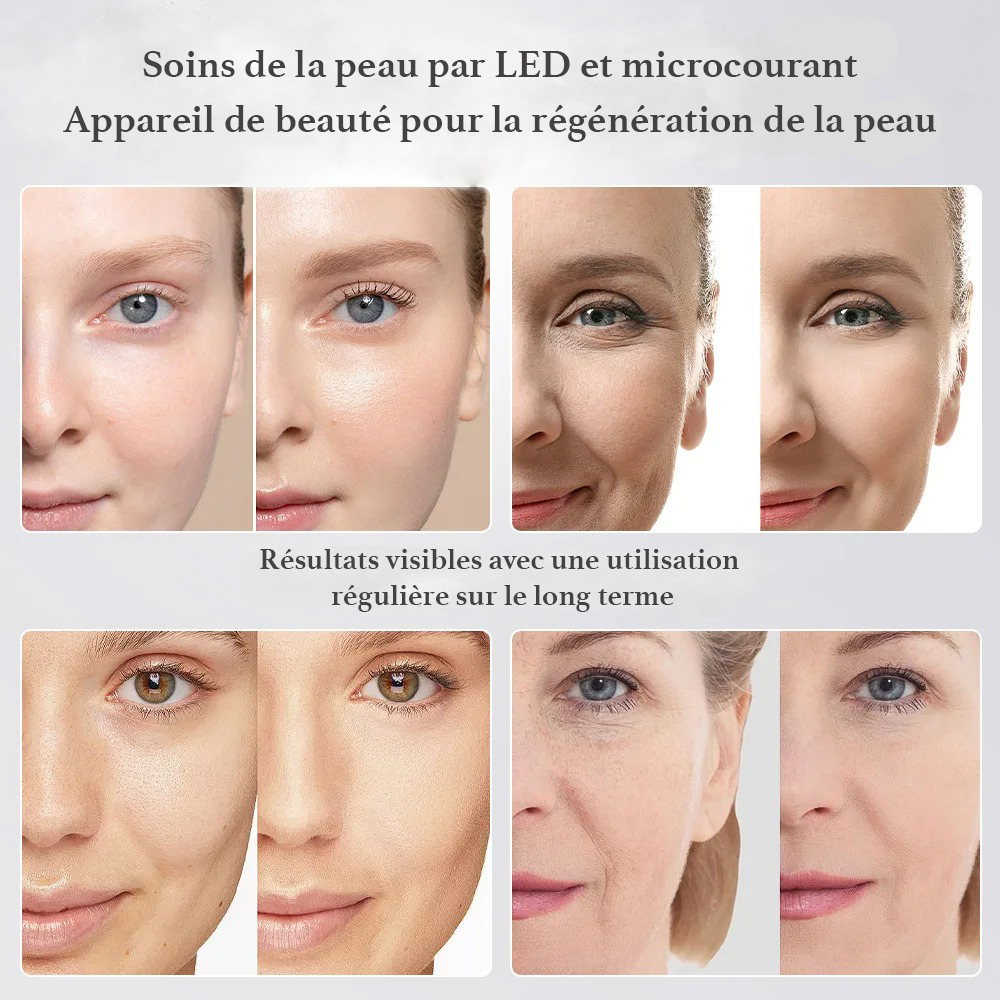 Appareil Facial 5‑en‑1 – LED Multicolore, EMS & Purification