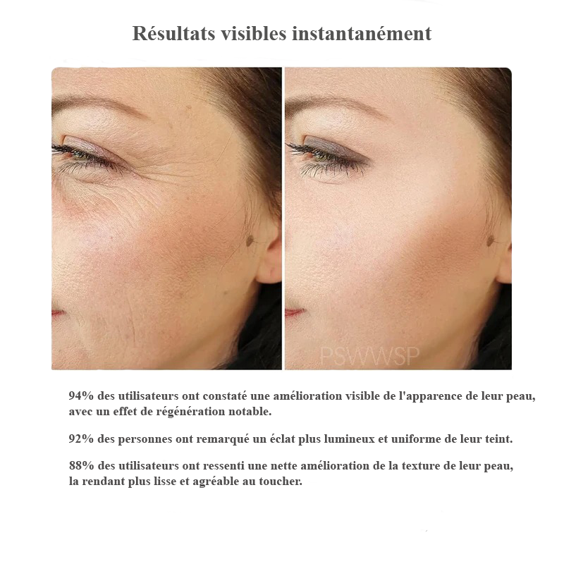 Appareil de beauté électrique pour les yeux et le visage – Massage, lifting et réduction des poches
