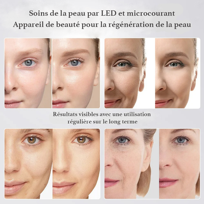 5-IN-1 FACIAL DEVICE – LED + EMS + PURIFICATION