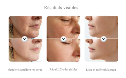 Masseur EMS Visage & Cou – Fermeté & Contour Remodelé